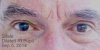 2014 09-05 R Eye Dilate 03 Shale.JPG