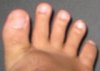 toes_spread.JPG