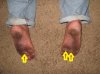 dirty_burned_and_blistered_soles_hottest_afternoon_heat_index_of_100_degrees_F_.jpg