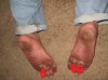 dirty_burned_and_blistered_soles_hottest_afternoon_heat_index_of_100_degrees_F_redirty.jpg