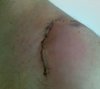 AdsShoulder.jpg