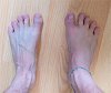 my toe spread june 3rd 2021 thumb.jpg