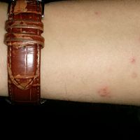 Bugs
