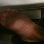 what happens when you use the tube without shoes